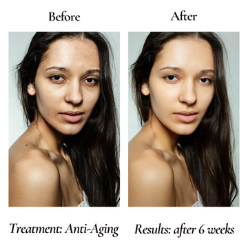 Anti-Aging Organic Facial Moisturizer