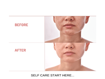 Organic Under Eye Youth Corrector and Neck Renewal Cream Duo