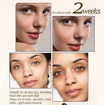 Korean Best Bleaching Brightening Face Whitening Cream for Dark Skin for Women